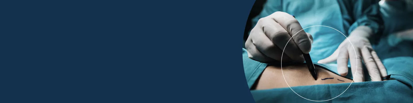 reconstruction corrections secondaires